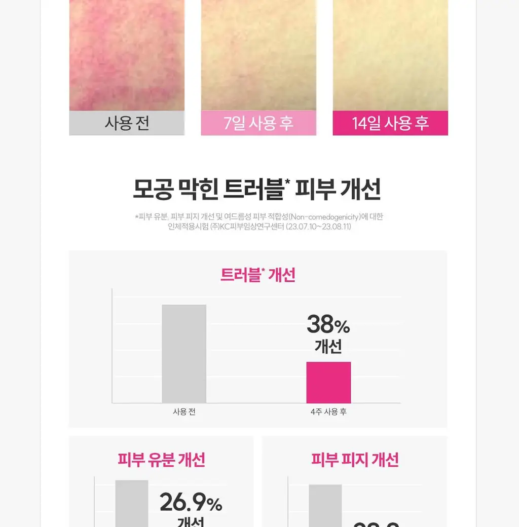 [응급진정/트러블케어] 로벡틴 시카케어 블레미쉬 클리어링 크림 50ml 리필기획 (+리필 40ml) 상세페이지 11